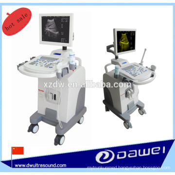 medical ultrasound machine price &sonoscape ultrasound equipment